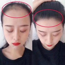 (Viya recommended buy 2 get 1 free) hairline growth fluid farewell to the big forehead artifact do not bald forehead