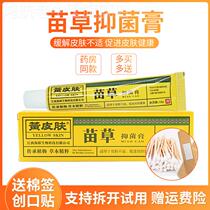 Yellow skin cream bacterial anachronization herb of anti-itching sea biological ointment originally known as the Solid King