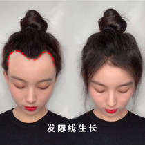 (Li Jiaqi recommended buy 2 get 1 free) hairline growth fluid farewell to the big forehead artifact do not be bald forehead