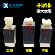 Dental root tube model root tube practice block with crown expansion practice root tube examination practical root tube 5 pieces