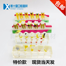 Dental Oral model Periodontal classification Caries development model Premolar Incisors Endodontic Doctor-patient communication Dental model