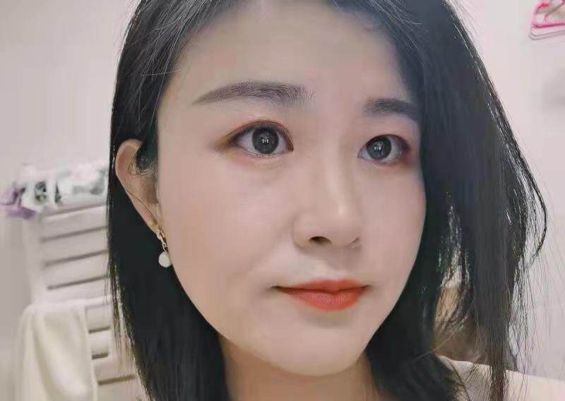 【独家爆料】仁和匠心祛痘液态精华怎么样？一定要了解的评测情况