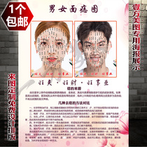 Men and womens facial mole figure point mole poster picture beauty freckle removal mole face mole removal face mole removal custom painting