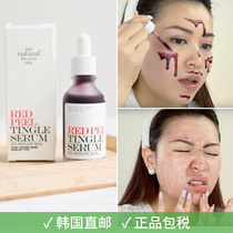Korean Sonatural Red peel tingle serum Blackhead Exfoliating essence kz hd