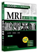 Video Reading ---MRT Reading Guide ( Second Edition ) 9787122161369 Chemical Industry Press