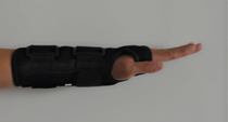 Wrist fixing strap wrist brace wrist brace arm fracture protection bracket radial bone sprain fixation splints