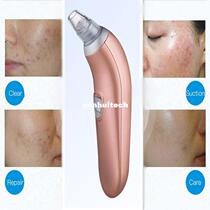 2022 new  Facial Spot Cleaner Vacuum Blackhead Remover Face