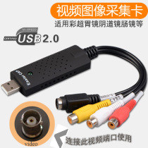 B-ultrasound endoscope gastroenteroscope colposcopy USB interface acquisition card Notebook color ultrasound colposcopy acquisition card