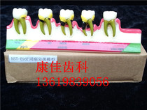 Dental Material Dental Decomposition Model Communication Teaching Teaching Dental Oral Material M8