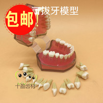 Dental dentistry Full mouth removable tooth extraction model Practice tooth extraction teaching aids with clear root ridge 