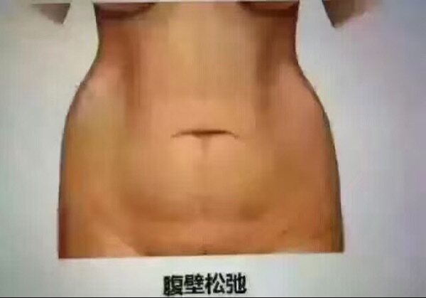 Corset amincissant - Ref 687707 Image 10