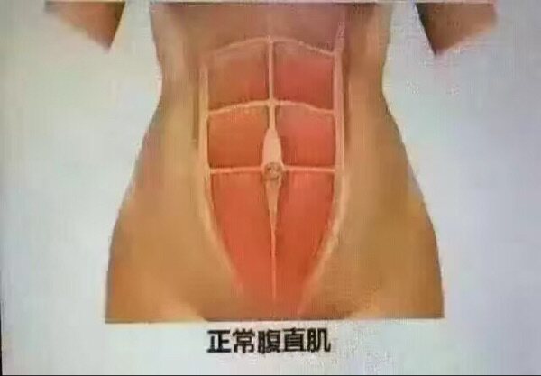 Corset amincissant - Ref 687707 Image 12