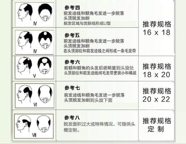 Extension mèches - Ref 225131 Image 10