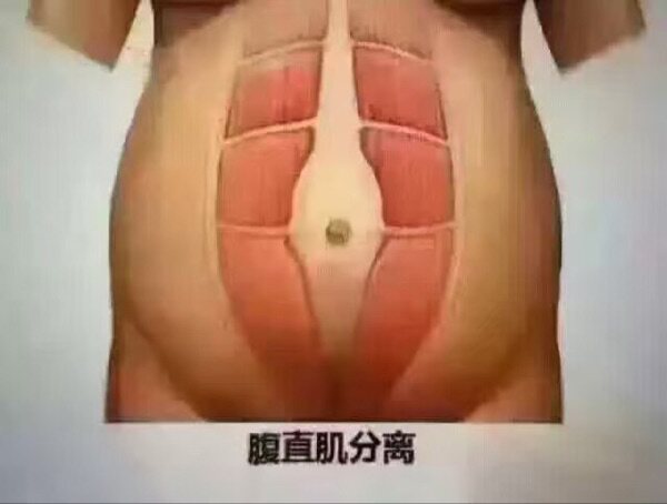 Corset amincissant - Ref 687707 Image 11