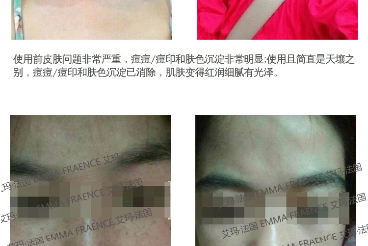 EGF sửa chữa chất lỏng ban đầu chống nhăn làm săn chắc lỗ chân lông vàng lá tinh chất viên nang mặt hydrating làm sáng tông màu da toner rau má skin1004