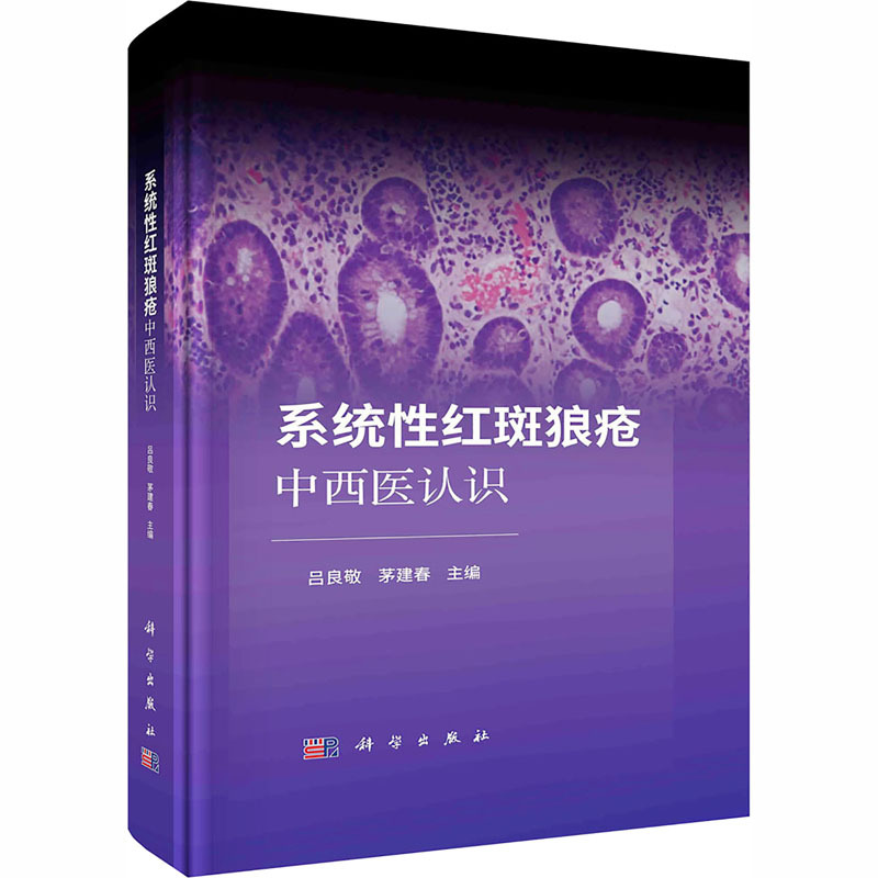 Understanding of Systemic Lupus Erythematosus in Traditional Chinese and Western Medicine: Authentic Books, Xinhua Bookstore Flagship Store, Wenxuan Official Website, Science Press Understanding of Systemic Lupus Erythematosus in Traditional Chinese and Western Medicine: Authentic Books, Xinhua Bookstore Flagship Store, Wenxuan Official Website, Science Press