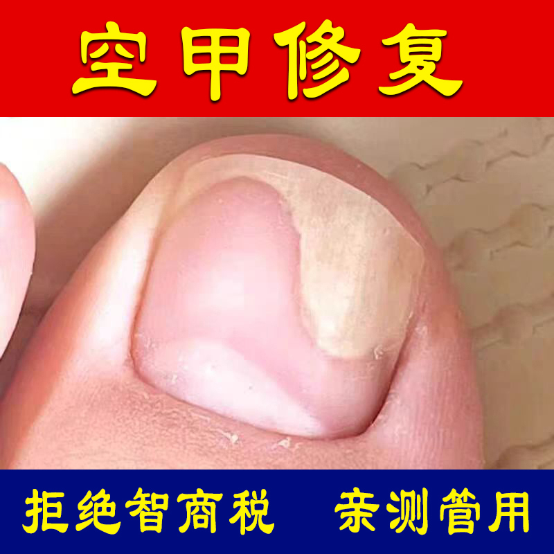 Treatment Solution for Separated Nail Beds and Hollow Nails, Specialized for Damaged Nails, Layered Vertical Lines, Peeling, Uneven Surfaces Treatment Solution for Separated Nail Beds and Hollow Nails, Specialized for Damaged Nails, Layered Vertical Lines, Peeling, Uneven Surfaces