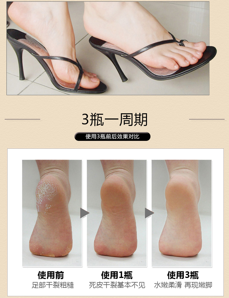 Gót chân khô nứt nẻ nứt nẻ chống nứt chân chăm sóc chân kem dưỡng ẩm tay nữ không dầu ngựa tẩy da chết gót chân