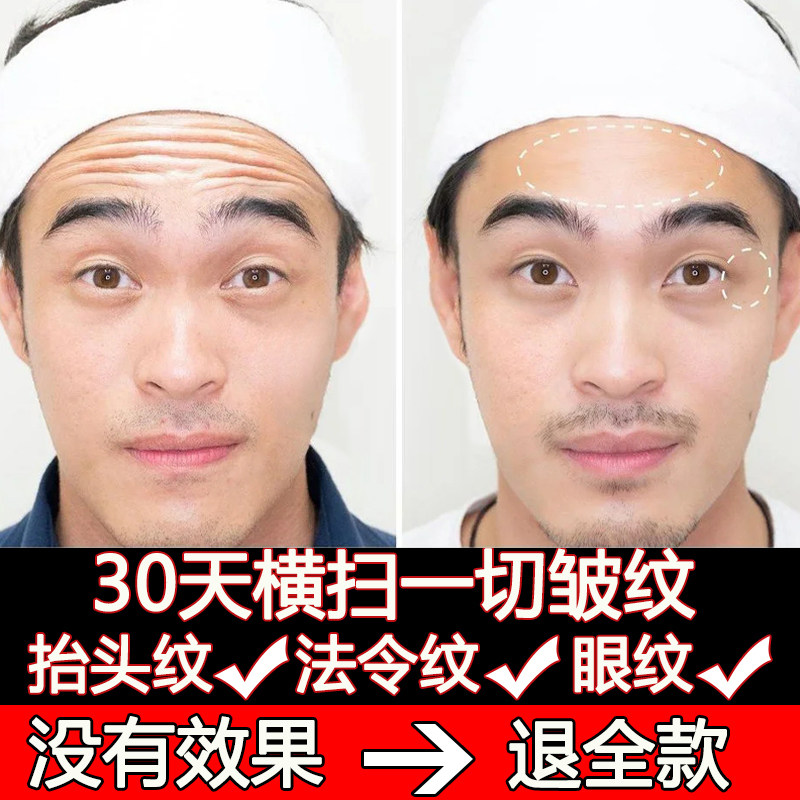 Remove wrinkle artifacts to lift the wrinkle star men Tight tight face cream anti-initial repair skin care