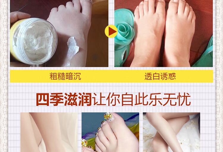 Gót chân bong tróc nứt chân kem chân 搓 bùn chà lên da chết già da dày mềm chân chăm sóc nuôi dưỡng kem trị nứt gót