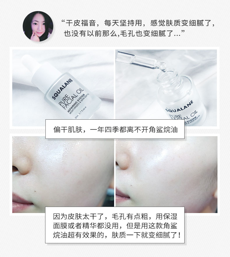 JOJOZEN squalane dầu làm đẹp sống Dầu squalane sửa chữa da mặt tinh chất dưỡng ẩm khóa nước giữ ẩm 20ml serum rau ma