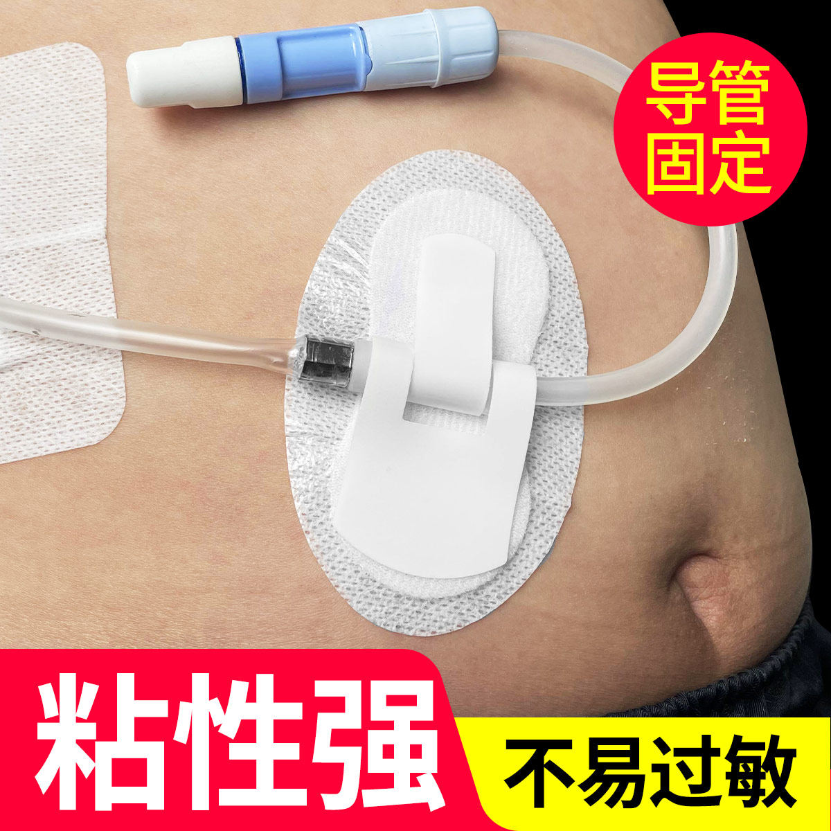 腹透导管固定贴蝴蝶型引流管固定装置 胆管引流固定医疗级 10片独立包装