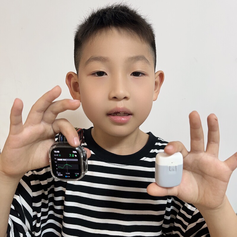 Yiyu A8 Insulin Pump Remote Control Closed-Loop Trial Watch Full Network Aaps Closed-Loop Yiyu Children's Watch