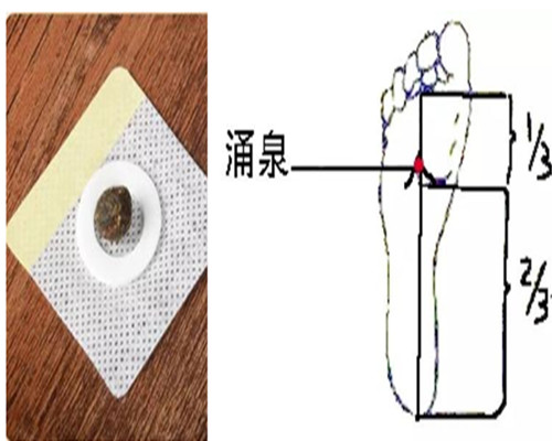 Baby igniting fire down stickers children's antipyretic stickers sore throat tonsils swollen tongue red tongue tip red tempered and easy to get angry - Taobao