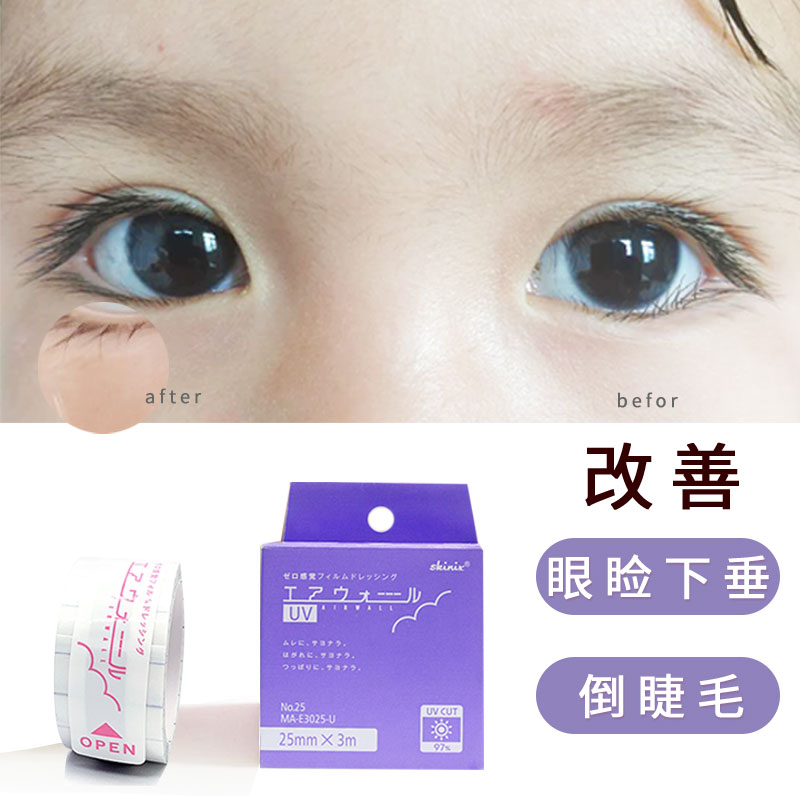 Spot Japan Made Adult Child Converse Eyelash Correction Sticker Anti Eyelid Drooping Eyelid Elastic adhesive tape