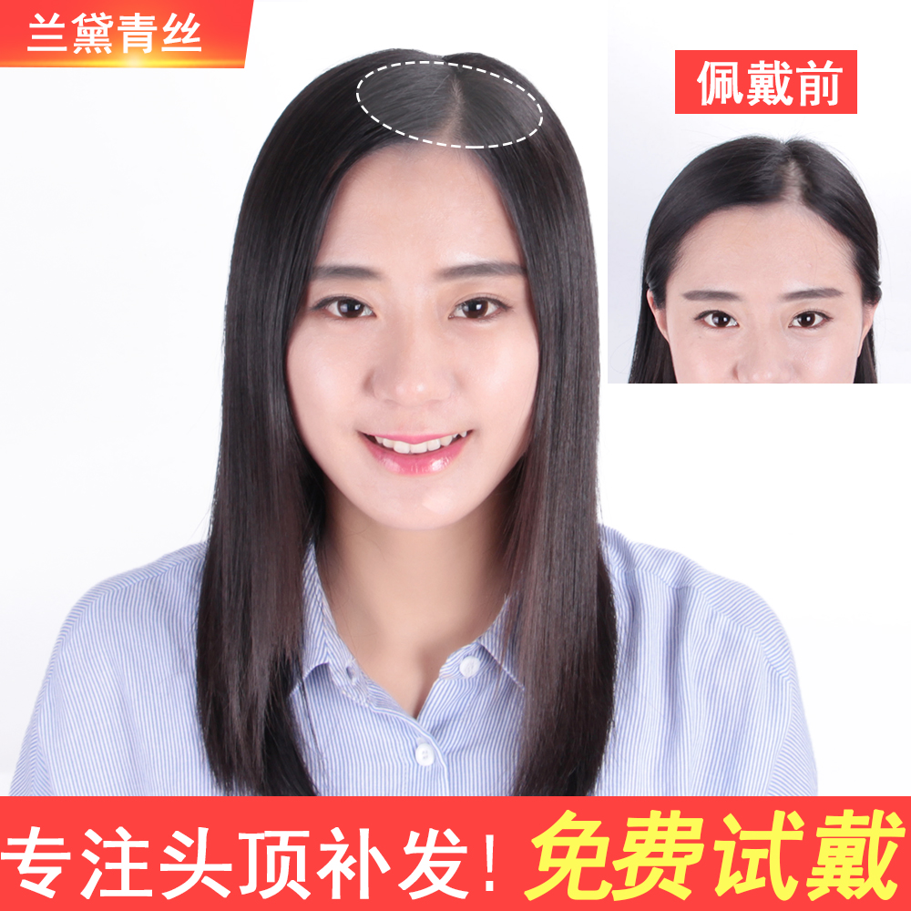 补发片女真发发片遮白发块补真人发丝隐形无痕假发片头顶