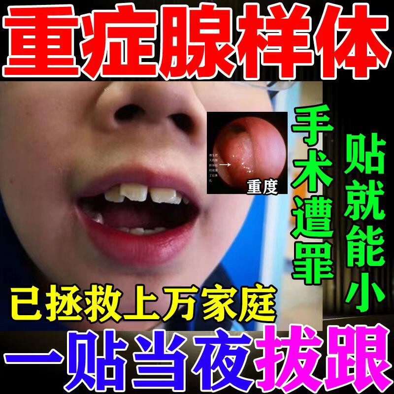 Adenoid hypertrophy Chinese medicine paste (special treatment) conditioning children's nasal congestion, snoring, open mouth and snoring artifact plaster