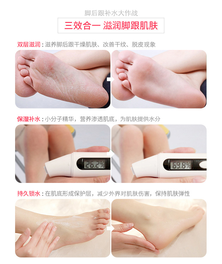 Cửa hàng chính thức của Hồng Kông Sasa Salsa Wanning Watson kem nứt gót chân