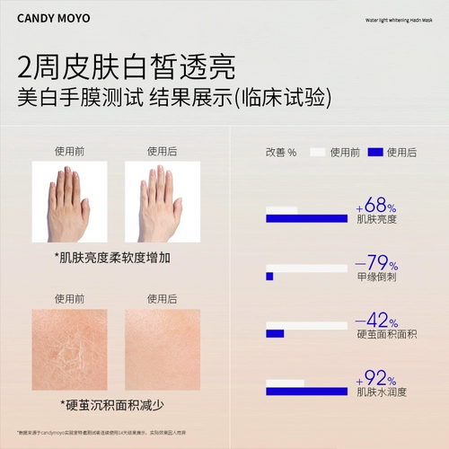 CandyMoyo, отбеливающая увлажняющая осветляющая питательная лечебная маска для рук для рук, против морщин