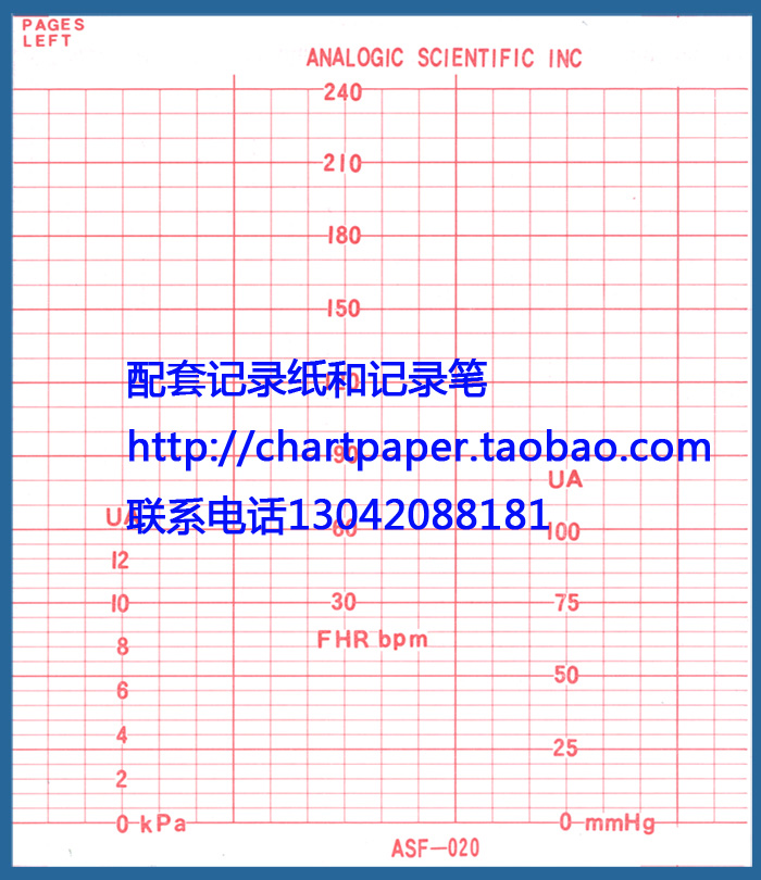 ANKE ASF-020 Fetal monitoring paper Fetal monitoring record copy paper 107mmx100m-150P
