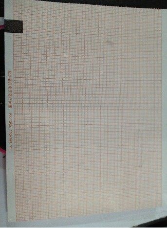 FUKUDA FX-7202 SE-601 ECG paper FUKUDA ECG paper 110mmx140mm-20m