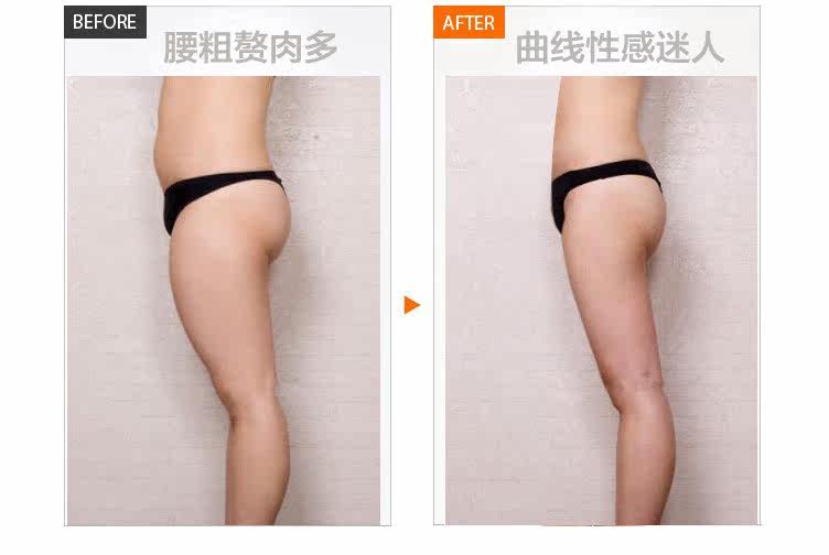 body amincissant en soie Ice - Ref 672801 Image 13