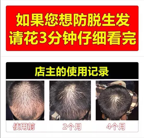 德生源 Быстрый лосьон для волос, плотная увеличивающая краска для волос для роста волос подходит для мужчин и женщин