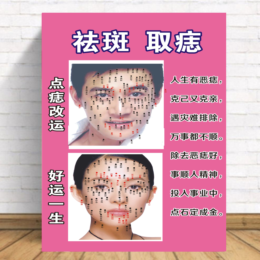 Men and women Mole Photos Posters Beauty Salon Wellness Club Nevus mole Point Mole Dot of Chinese Medicine Health Preservation Decoration Painting Hanging Painting-Taobao