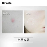 Розовый восстанавливающий лосьон с салициловой кислотой от черных точек подходит для мужчин и женщин, анти-акне, скрывает прыщи