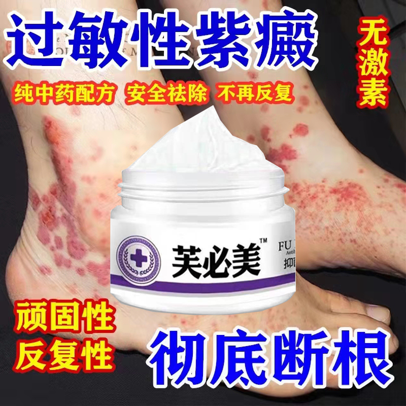 Treatment of pigment allergic purpura ointment subcutaneous hemorrhage red dot stasis purpuric dermatitis vasculitis special medicine