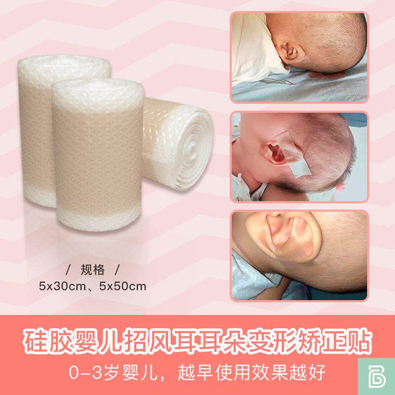 Newborn ear aligner Baby ear correction stickers Newborn auricle ear stickers Styling stickers Infant anti -