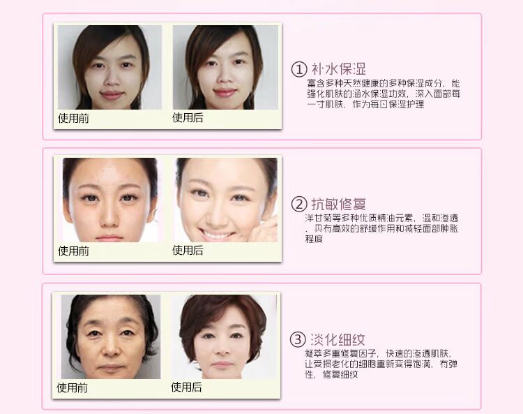 Đích thực Rui Yu Li Chamomile Vàng Dầu Nâng Làm Săn Chắc Chống Nhăn Nhăn Khử Mùi Dòng Fine Kem Dưỡng Ẩm mặt nạ dưỡng ẩm cho da khô