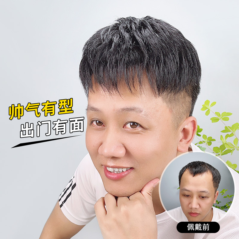 Men's forehead Intertextures Hair Clots Real Hair Fake Hair patch Hair Patches Invisible no marks Old Head Bald Top Hair