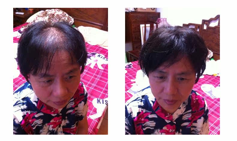 Extension cheveux - Ref 220196 Image 35