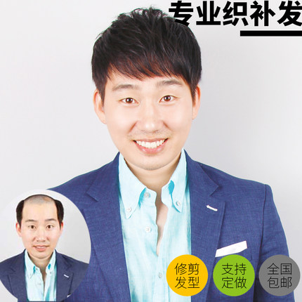 男士假发补发