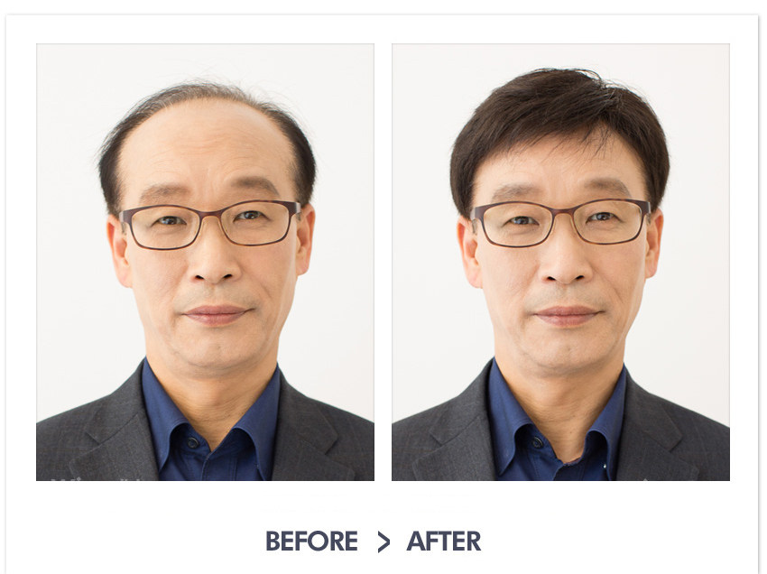 Extension cheveux - Ref 217174 Image 26