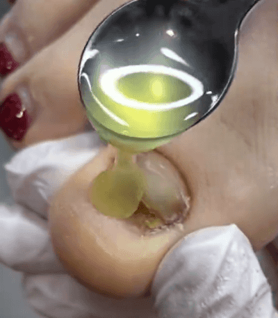 25.gif