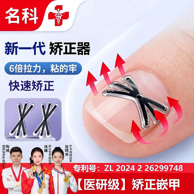 Mingke Ingrown Toenail Correction Device, Nail Patch for Inflamed Ingrown Toenails, Adjusts and Shapes the Nail Shape Mingke Ingrown Toenail Correction Device, Nail Patch for Inflamed Ingrown Toenails, Adjusts and Shapes the Nail Shape