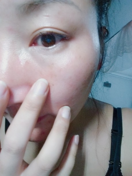 hkh化妆品是什么牌子，HKH补水美肌护肤面部套装怎么样，用了效果如何