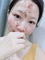 My only desensitization moisturizing essence 1 5ML with lavender film